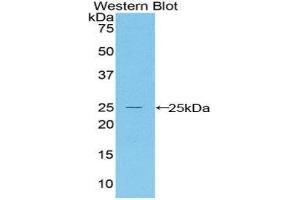 Western Blotting (WB) image for anti-BCL2-Associated X Protein (BAX) (AA 1-158) antibody (ABIN1858117) (BAX antibody  (AA 1-158))