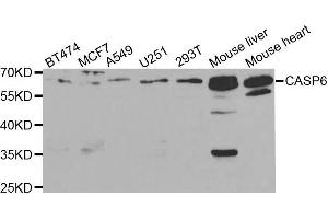 Western blot analysis of extracts of various cell lines, using CASP6 antibody. (Caspase 6 antibody  (AA 24-293))