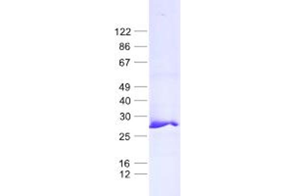 MRPL24 Protein (His tag)