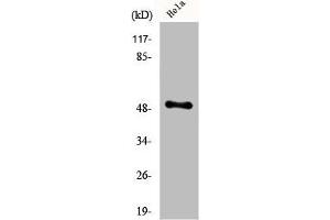 Western Blot analysis of Jurkat cells using Egr-2 Polyclonal Antibody (EGR1 + EGR2 (C-Term) antibody)