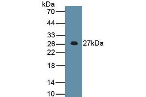 Western Blotting (WB) image for Apolipoprotein B (APOB) ELISA Kit (ABIN6730915)