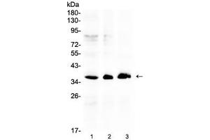 Western blot testing of human 1) HeLa, 2) COLO320 and 3) SW620 cell lysate with AKR1B10 antibody at 0. (AKR1B10 antibody  (AA 285-316))