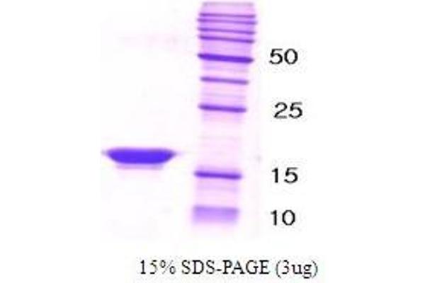 beta Synuclein Protein