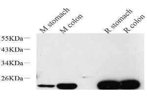 Western Blot analysis of various samples using TAGLN Polyclonal Antibody at dilution of 1:600. (Transgelin antibody)