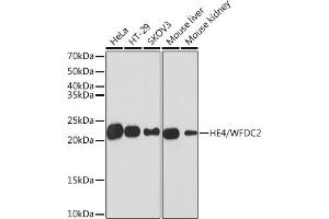 Western blot analysis of extracts of various cell lines, using HE4/WFDC2 Rabbit mAb (ABIN1682653, ABIN3017632, ABIN3017633 and ABIN7101513) at 1:1000 dilution. (WFDC2 antibody)