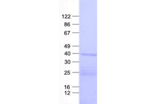 CHST6 Protein (His tag)