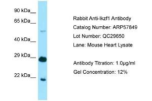 Western Blotting (WB) image for anti-IKAROS Family Zinc Finger 1 (Ikaros) (IKZF1) (N-Term) antibody (ABIN2787426) (IKZF1 antibody  (N-Term))