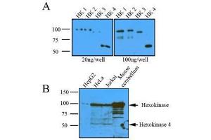 Western Blotting (WB) image for anti-Hexokinase 1 (HK1) (AA 1-917), (N-Term) antibody (ABIN317096) (Hexokinase 1 antibody  (N-Term))