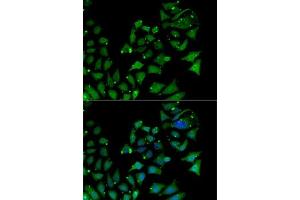 Immunofluorescence analysis of MCF7 cells using  antibody (ABIN6129963, ABIN6136690, ABIN6136692 and ABIN6218362). (AIPL1 antibody  (AA 1-384))