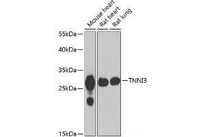 Western blot analysis of extracts of various cell lines using TNNI3 Polyclonal Antibody at dilution of 1:1000. (TNNI3 antibody)