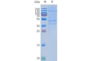 Human -Nanodisc, Flag Tag on SDS-PAGE (CCR2 Protein)