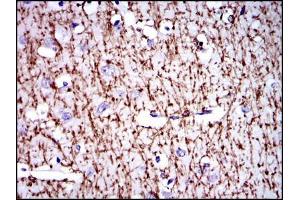 Immunohistochemical analysis of paraffin-embedded brain tissues using MBP mouse mAb with DAB staining. (MBP antibody)
