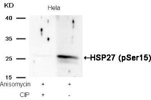 Western blot analysis of extracts from Hela cells, treated with Anisomycin or calf intestinal phosphatase (CIP), using HSP27 (Phospho-Ser15) Antibody. (HSP27 antibody  (pSer15))