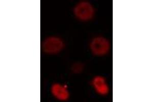 ABIN6274512 staining NIH-3T3 cells by IF/ICC. (ZSCAN16 antibody)