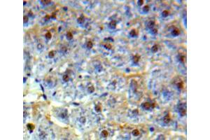 Used in DAB staining on fromalin fixed paraffin-embedded liver tissue (HMGB2 antibody  (AA 2-187))