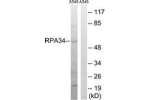 Western blot analysis of extracts from A549 cells, using CD3EAP Antibody. (CD3EAP antibody  (AA 441-490))