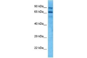 Host:  Mouse  Target Name:  KCND3  Sample Tissue:  Mouse Spleen  Antibody Dilution:  1ug/ml (KCND3 antibody  (C-Term))