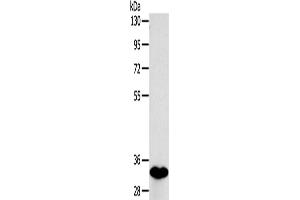 Western Blotting (WB) image for anti-Sulfotransferase Family 1B Member 1 (SULT1B1) antibody (ABIN2424229) (SULT1B1 antibody)