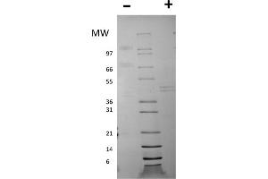 SDS-PAGE of Mouse Interleukin-12 Recombinant Protein SDS-PAGE of Mouse Interleukin-12 Recombinant Protein. (IL12 Protein)