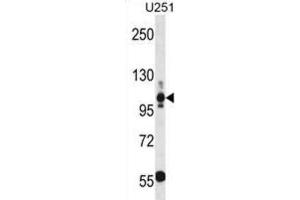 Western Blotting (WB) image for anti-Thrombospondin 3 (THBS3) antibody (ABIN3000607) (THBS3 antibody)