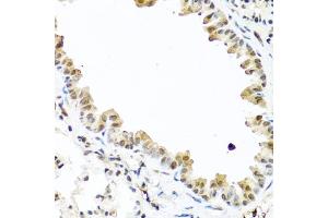 Immunohistochemistry of paraffin-embedded mouse lung using TET2 antibody (ABIN6133019, ABIN6149017, ABIN6149019 and ABIN6221336) at dilution of 1:100 (40x lens). (TET2 antibody  (AA 1833-2002))