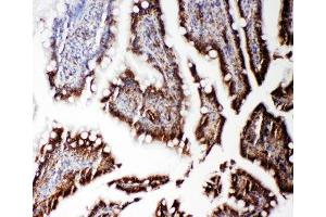 IHC-P: RGS3 antibody testing of rat intestine tissue (RGS3 antibody  (C-Term))
