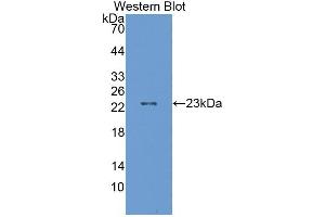 Western blot analysis of the recombinant protein. (ALDH9A1 antibody  (AA 322-494))