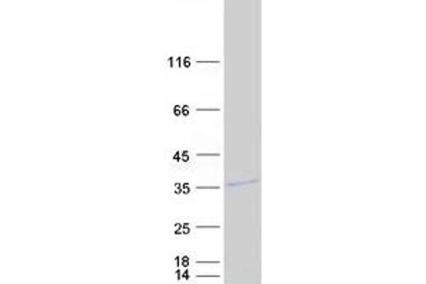 MARCH8 Protein (Transcript Variant 6) (Myc-DYKDDDDK Tag)