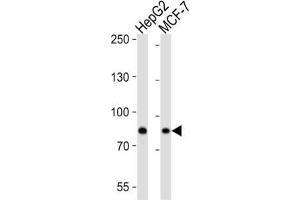 Western Blotting (WB) image for anti-Ubiquitin Specific Peptidase 51 (USP51) antibody (ABIN3004645) (USP51 antibody)