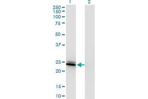 Western Blot analysis of BIN3 expression in transfected 293T cell line by BIN3 monoclonal antibody (M09), clone 4E12. (BIN3 antibody  (AA 154-253))