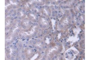 Detection of ADD1 in Mouse Kidney Tissue using Polyclonal Antibody to Alpha Adducin (ADD1) (alpha Adducin antibody  (AA 388-560))