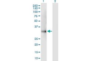 Western Blotting (WB) image for UCP2 293T Cell Transient Overexpression Lysate(Denatured) (ABIN1333848)