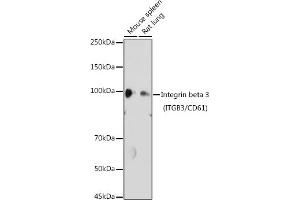 Western blot analysis of extracts of various cell lines, using Integrin beta 3 (ITGB3/CD61) antibody (ABIN6127572, ABIN6142584, ABIN6142586 and ABIN6219636) at 1:1000 dilution. (Integrin beta 3 antibody  (AA 610-718))