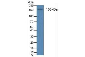 Detection of INSR in Human Blood Cells using Polyclonal Antibody to Insulin Receptor (INSR) (Insulin Receptor antibody  (AA 1024-1298))