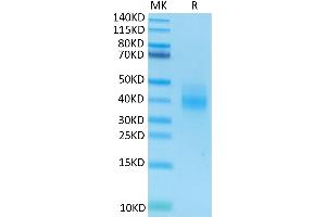 Human NKG2A&CD94 on Tris-Bis PAGE under reduced condition. (NKG2A & CD94 protein (His-Avi Tag))