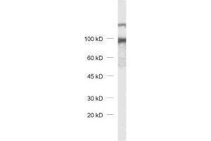 dilution: 1 : 1000, sample: rat brain homogenate (DAP antibody)
