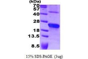 Figure annotation denotes ug of protein loaded and % gel used. (Syndecan 4 (SDC4) (AA 19-145) Peptide)