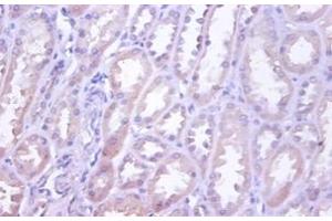 Immunohistochemistry of paraffin-embedded human kidney using TNFRSF10D / TRAIL-R4 / DCR2 antibody at dilution of 1:100. (DcR2 antibody)