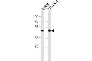 Western Blotting (WB) image for anti-ECSIT (ECSIT) antibody (ABIN2998295) (ECSIT antibody)