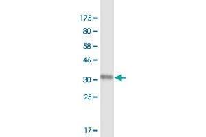 Western Blot detection against Immunogen (35. (RARRES1 antibody  (AA 205-294))