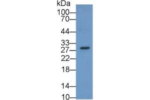 Detection of SOX2 in Fetal Rat lysate using Monoclonal Antibody to Sex Determining Region Y Box Protein 2 (SOX2) (SOX2 antibody  (AA 105-317))