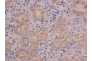 IHC-P analysis of Human Stomach Tissue, with DAB staining. (PIGR antibody  (AA 462-561))