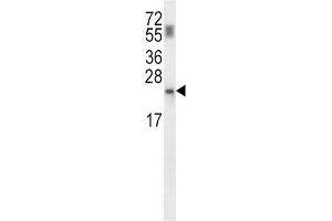 Western Blotting (WB) image for anti-phosphopantothenoylcysteine Decarboxylase (PPCDC) antibody (ABIN2997652) (PPCDC antibody)