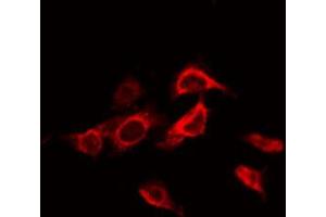 ABIN6272254 staining K562 by IF/ICC. (ADRB3 antibody  (Internal Region))