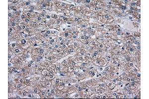 Immunohistochemical staining of paraffin-embedded Human liver tissue using anti-TBXAS1 mouse monoclonal antibody. (TBXAS1 antibody)