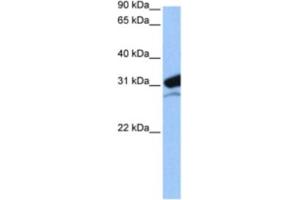 Western Blotting (WB) image for anti-Mitochondrial Ribosomal Protein L24 (MRPL24) antibody (ABIN2462302) (MRPL24 antibody)