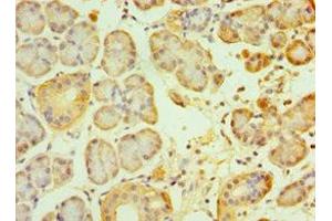 Immunohistochemistry of paraffin-embedded human pancreatic tissue using ABIN7153890 at dilution of 1:100 (GCK antibody  (AA 1-300))