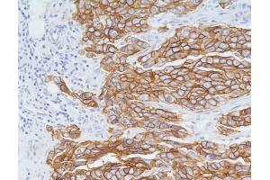 Immunohistochemistry (IHC) image for anti-Receptor tyrosine-protein kinase erbB-2 (ErbB2/Her2) (Extracellular Domain) antibody (ABIN6655455)