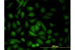 Immunofluorescence of monoclonal antibody to PRKAB1 on HeLa cell. (PRKAB1 antibody  (AA 1-270))