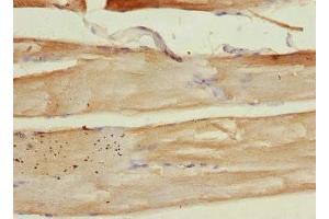 Immunohistochemistry of paraffin-embedded human skeletal muscle tissue using ABIN7149412 at dilution of 1:100 (PLA2G4C antibody  (AA 1-189))